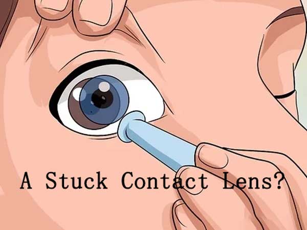 How To Handle A Stuck Contact Lens Esoeye